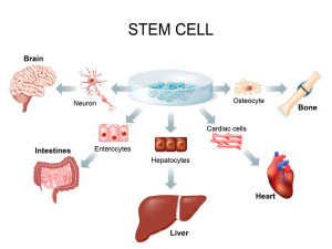 63923714 - stem cell application. using stem cells to treat disease