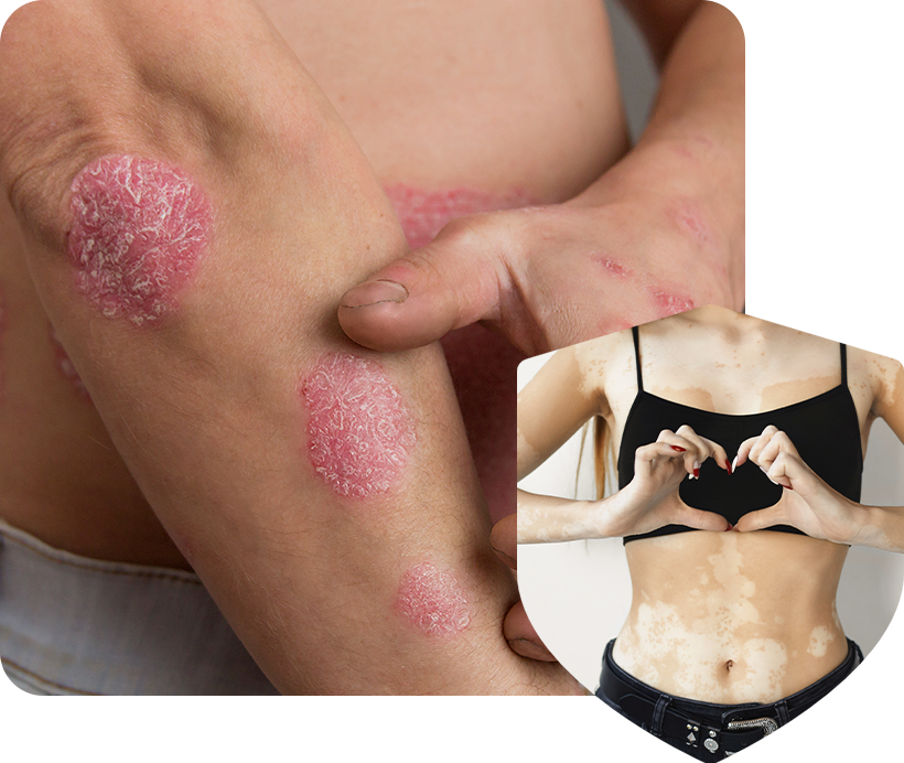  CIRS Mold Toxicity Treatment In Bethesda Bethesda, MD